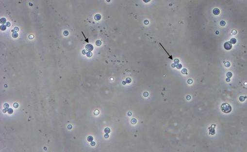 酵母双杂交技术原理、试验流程、特点以及应用