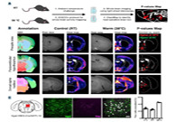减肥药瞄准新靶点，强效减肥药即将来袭？