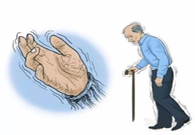 帕金森。芭痢辈慌？