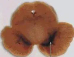 正常人：正：谥