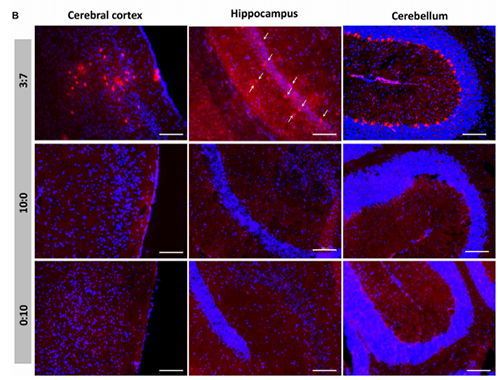 被包裹在含有NT-类脂质的LNP中的Cre重组酶成功转移。大脑中的转染神经元呈红色高亮。