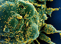 唾液检测新冠抗体新方法来了，获取结果仅需几小时！