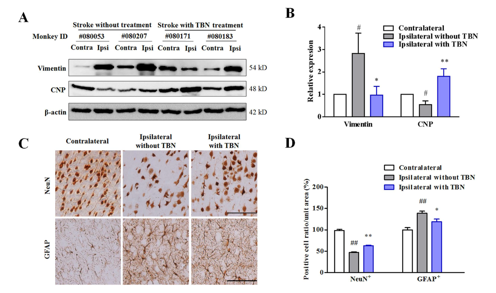 TBN是一种治疗缺血性卒中的新型临床候选药物，本研究中TBN通过不朽情缘mg官网合成